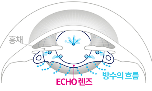원뿔형 중심홀을 통해 방수의 흐름을 개선한 ECHO 렌즈 구조