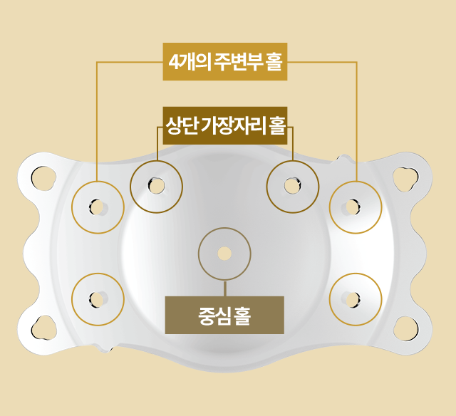 중심 홀 1개, 상단 가장자리 홀 2개, 주변부 홀 4개로 구성된 ECHO ICL 렌즈 구조