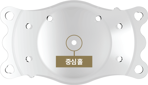중심 홀이 표시된 ECHO ICL 렌즈 구조