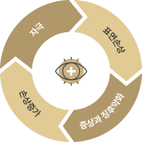 자극, 표면손상, 증상및정확화, 신경증가가 순환하는 안구건조증 악화 다이어그램