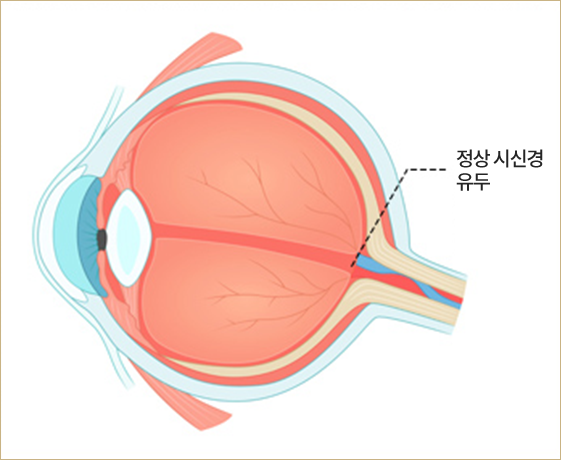 normal eye