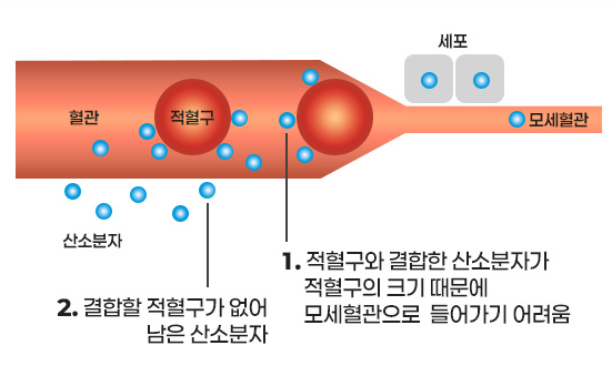 보통 1기압일 때의 혈관 상태