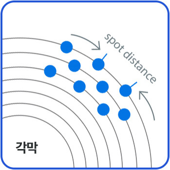 스마일NOCA프로 라식의 균등한 레이저 조사 방식