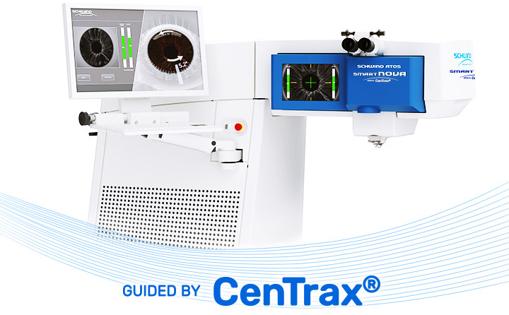 SCHWIND ATOS SMART NOVA와 CenTrax 시스템
