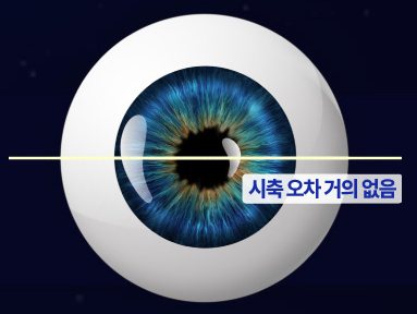 7세대 스마일NOVA프로 라식 시축 자동 보정 예시